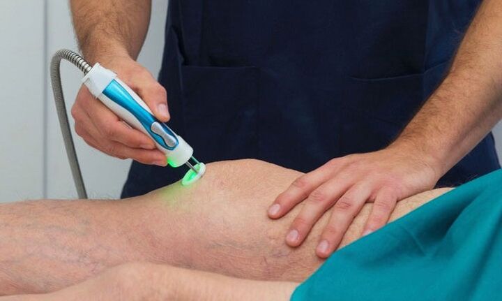 termografia e kyçit të gjurit me artrozë